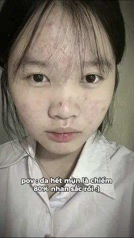 vẫn còn thâm mà cứ từ từ 😆#xh #xhtiktok 