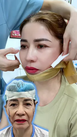 #nangmuicautruc #catmi #cangdamat #suamuihong #cangdamini