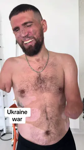 Ukrainian soldier injured  #ukraine🇺🇦 #ukraina #ukraine #kyiv #kyivukraine 