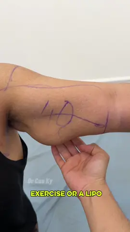 One arm sags. #beauty #skincare #skincareroutine #arm #SelfCare 