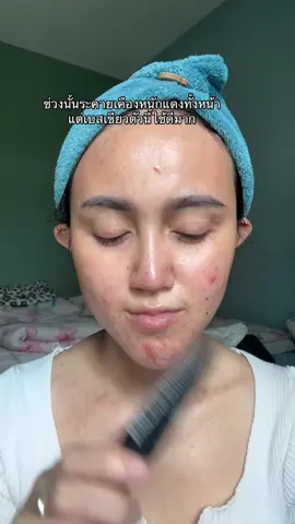 #เบสเขียว 