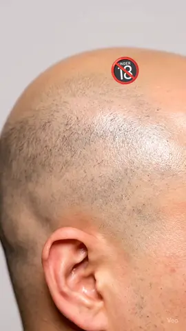 curly hair growth spray video. #foryou #curly #hair #trendingclip #fypシ゚viral🖤tiktok☆♡🦋myvideo❤️❤️🥰🥰🥰 