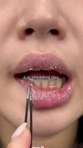 Crusty lips? Nope, not today Exfoliated + glossed with @SKINTIFIC Official  #peptide #lipcare #lipcombo #amazon #drylips 