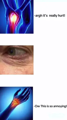 مزررعج😞#myokymia #eyepain #kneepain #handpain #jointpain 