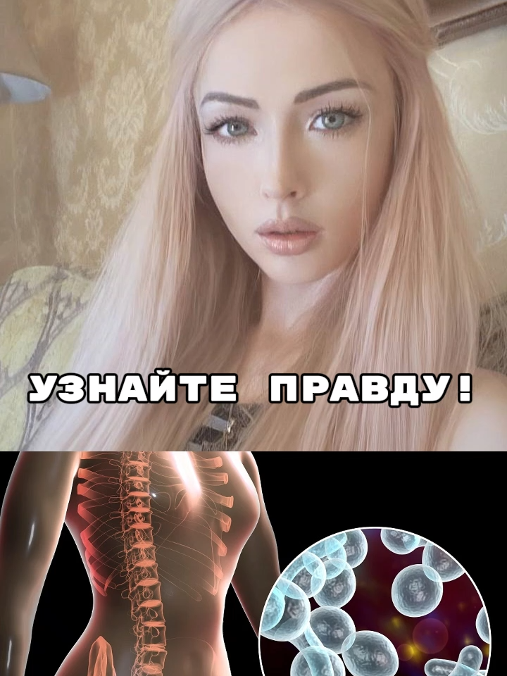 Я За Свободу От Грибков ! Когда организм очищается от грибков и других паразитов - приходит настоящее облегчение. ✨ Уходит вялость, усталость, хандра. 🔥 Тело оживает: больше энергии, крепкий иммунитет, лёгкость в движении. Болезни начинают отступать, кожа и волосы оживают, появляется сила жить на полную. Это естественное состояние вашего организма, когда он наконец-то свободен от посторонних жильцов.