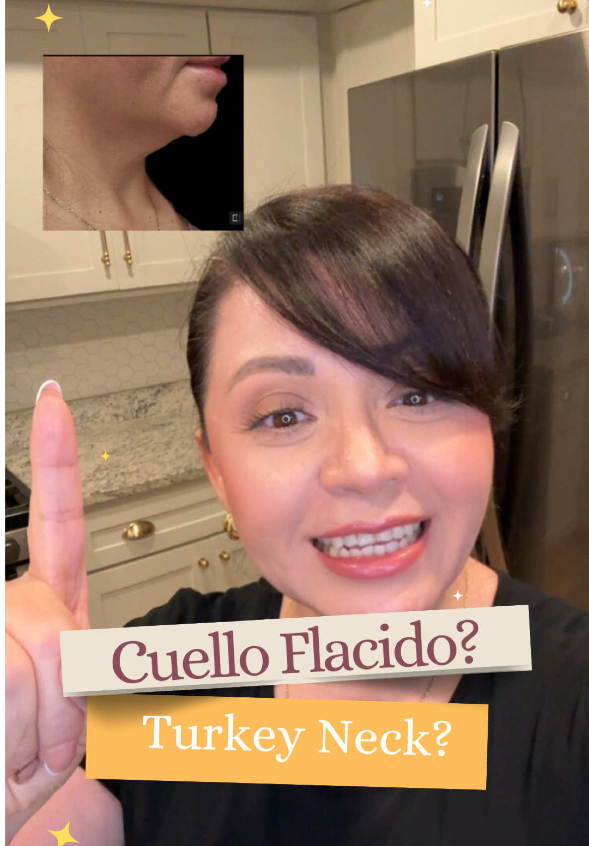 🦃  La mejor crema reafirmante y tensora para el cuello , perdi 40 lbs lo cual el pronostico era cuello flacido y colgado la crema la utilizo dos veces al dia hasta el momento llevo 2 tarros y ha valido la pena!! Buscala en amazon! 🦃 @Gopure The best firming and tightening cream for the neck. I lost 40 lbs, which was expected to result in a sagging and droopy neck. I use this cream twice a day. So far, I've used 2 jars, and it's been worth it! Look for it on Amazon! #saggyskin #antienvejecimiento #skincare #skincareroutine #coffee 