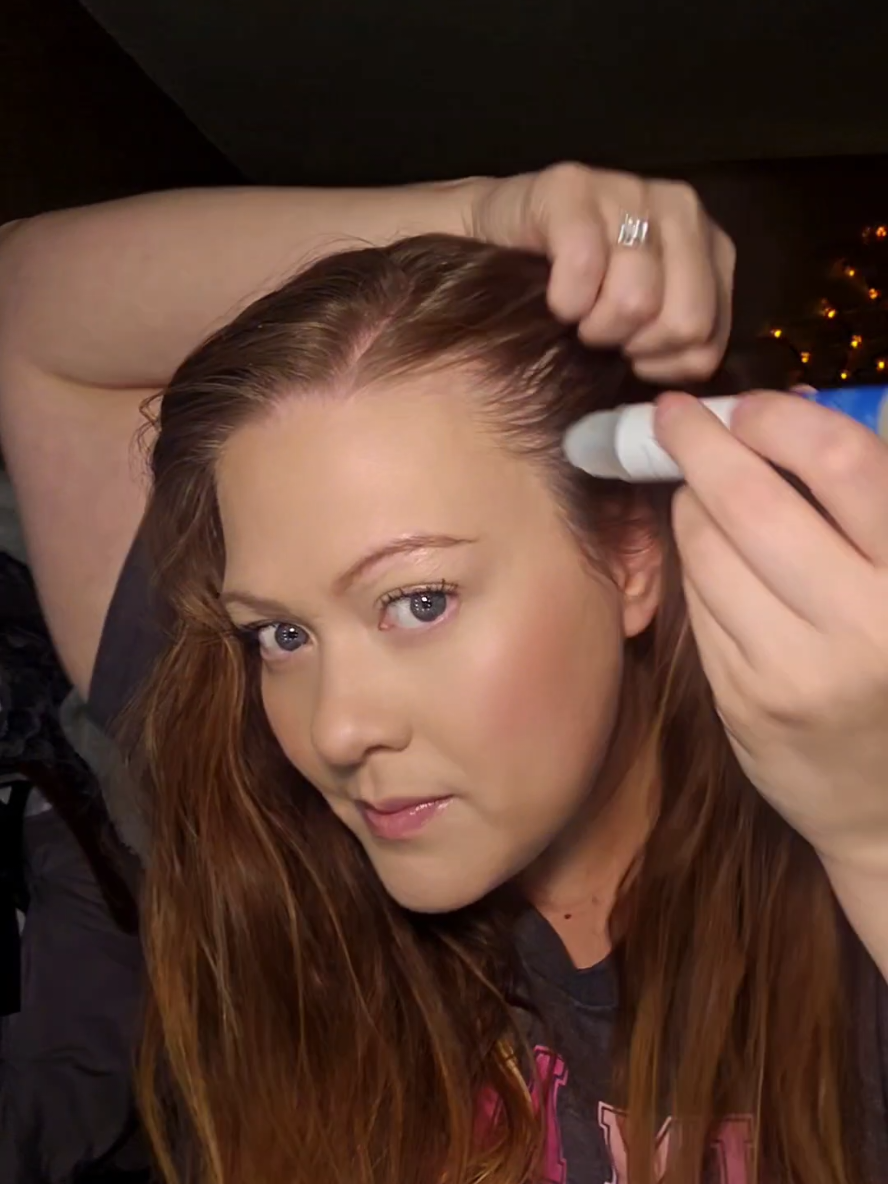 #hairserum #thinninghairsolution #hairlosssolutions #reseedinghairline #tiktokshopfalldealsforyou 