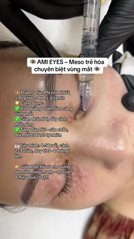 👁 AMI EYES – Meso trẻ hóa chuyên biệt vùng mắt, xoá nhăn giảm thâm #mayspa #trị_thâm_mắt #xoá_nhăn #meso_mắt_amie 