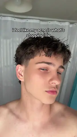 yall see the potential or im trippin?  #fyp #skincare #acne