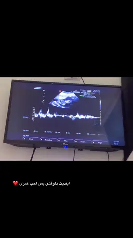 دلوقتي بس والله ❤️
