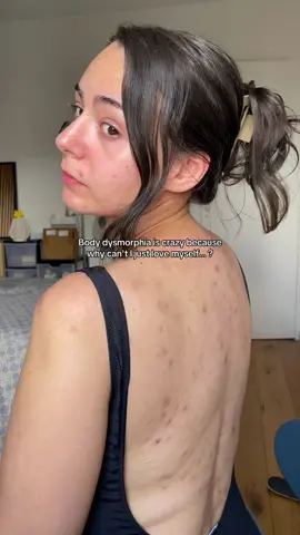 I know it's just acne, but it's exhausting… #acne #skincare #trend #skincareroutine 