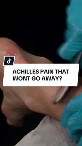 Achilles Pain That Won’t Go Away? It usually starts as a bit of stiffness in the heel when you get out of bed. You walk it off and think nothing of it. But then it lingers. Walking feels tight, running leaves it sore, and some days even pressing on the tendon is uncomfortable. Most people try stretching, resting, or swapping shoes. Sometimes it eases for a while, but the pain keeps coming back. That’s because the Achilles doesn’t just need time, it needs the right treatment. One approach we often use is an IASTM tool. By working along the tendon and surrounding calf tissue, it helps release stubborn tightness, improve blood flow, and calm down irritation. But the tool is just the start. Once the tendon is freer and less irritable, the real progress comes from building it back up with the right exercises at the right stage. That’s how you restore strength, stop the flare-ups, and get back to moving without pain. It’s not about doing everything, it’s about doing the right things in the right order, and that’s where recovery really happens. The Sharp Physio Team #achillespain #achillespainrelief #achillestendon #physio