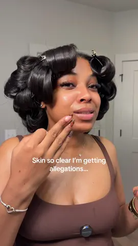 I’m not even mad, if only you knew how my skin used to look thank you Jiyu 🥹