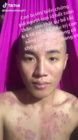 Mong cô chú a chị đi ngang giúp con 5k 10k để con được điều trị bệnh