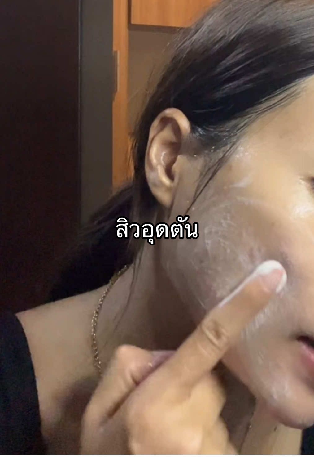 #สิว #สิวอุดตัน 