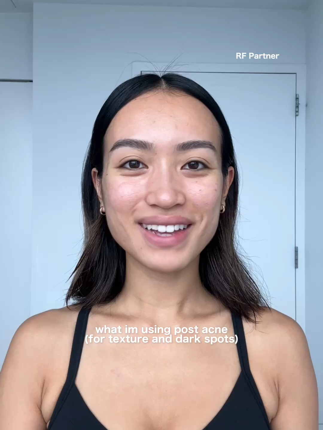 Dealing with the aftermath of acne, and this @rodanandfields Total RF Serum is what’s bringing my skin back to life. Shop online at rodanandfields.com #RFPartner #backtoskin #ad #lovewhatyousee