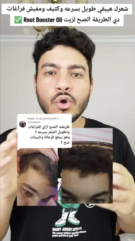 Replying to @garoufouad0الطريقة الكاملة لاستخدام الزيت كحمام زيت للفراغات وتطويل الشعر بسرعه ويبقي كثيف وتقيل والنتيجة بتظهر من اول اسبوع او اتنين والتحسن بيزيد مع الاستمرار #انبات_الشعر #تطويل_الشعر #شعر_كثيف #زيت_شعر 