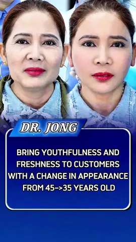 Bring youthfulness and freshness to customers, changing age from 45->35 years old. #fullfacelift #midfacelift #fyp #kualalumpur #drjong 