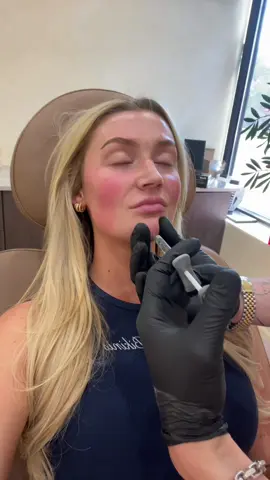 @Ali Shuayto the best of the best. Full face of filler for facial balancing🤍🤍  . And let me point out the obvious that changing anything about yourself normally comes from a place of being insecure. I used to be so insecure about my nose because I didn’t feel like it was proportionate to the rest of my face. Being on camera 24/7, it was all I saw. Enhancing my natural features like my cheekbones, chin and lips have made me so much happier with my facial symmetry. Big big fan of doing things that make you feel more you🤍