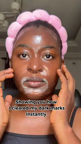 CALENDULA PEEL OFF MASK Infused with Salicylic Acid(BHA), PHA, and Niacinamide, it gently exfoliates blackheads, whiteheads, and dead skin cells Soothes irritation with real calendula flower extract. CARROTENE IPMP CLEARING SOLUTION Infused with BHA, PHA, Zinc oxide, and Niacinamide, it clears pimples and fades acne scars Promotes healing process faster without damaging skin barrier Non-drying, non-flaky #APRILSKIN #allurebestofbeauty #acnetreatment @aprilskin_official_shop