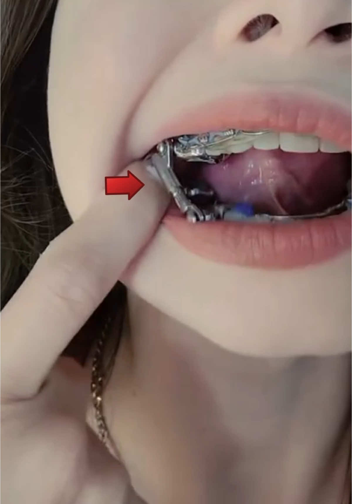 Зачем в рот вставляют телескопические штанги? Music from #InAudio: https://inaudio.org/ Infraction -  A Way to You #herbstappliance