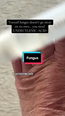 Don't wait, invest in your skin health and purchase your pen now! Treats Athlete's Foot, Jock Itch & Ringworm!! #nailfungus #fungustreatment #nailtok #fungus