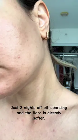 It’s only been two nights without oil cleansing and I can already see my skin calming down. I’ll keep this routine for a week and share how it goes when things hopefully get fully calm. Right now I’m just using Garnier micellar water on a pad until it’s clean, Lancome oil-based remover for eye makeup, and two steps of moisturizer (a simple one + barrier repair cream). Filmed on iPhone, which always makes my pores look extra large — but I don’t want that insecurity to stop me from showing my real skin. Skin has texture and that’s normal. 🌿 #fyp #skincare #acneprone #skincaretok #clearskinjourney 