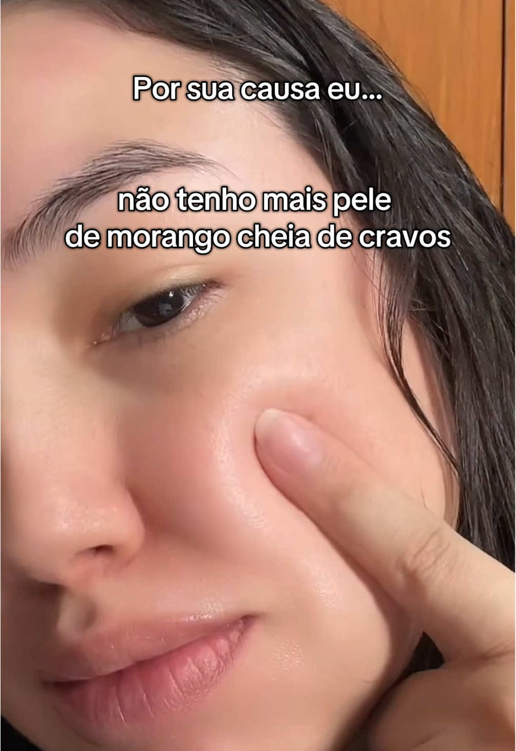 O segredo da pele perfeita! #niacinamida #simpleorganic #skincare #peleperfeita #tiktokshop 