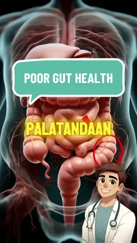 Senyales na mayroon kang poorn gut health #guthealth #digestivehealth #probiotics 