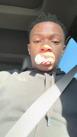 #fyp #funny #wisdomteethremoval 