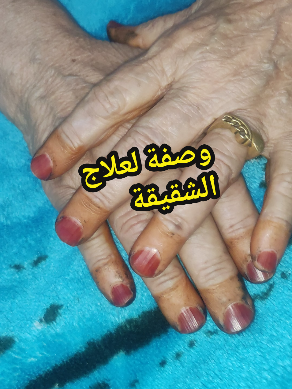 الرد على @3wachrya00  وصفة للشقيقة . تعديل: السمن يكون بدرجة حرارة الغرفة ليس بارد من الثلاجة. #وصفات_ناس_زمان  #ناس_زمان_قالوا  #tiktokalgeria  #explore  #dz 