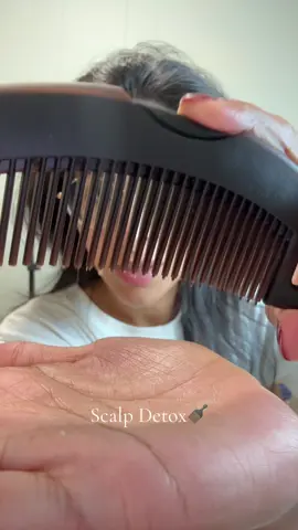 Ok this was so satisfying! #dandruff #haircare #dandruffremovel #hairtok #fyp 