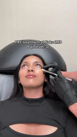 Went to @NAKEDᴹᴰ yesterday and had a great experience ✨  #prf #nakedmd #undereye 