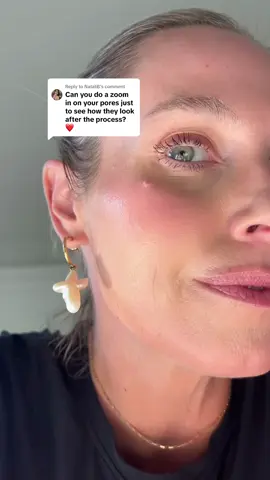 Replying to @NataliB filming pores is not easy but hopefully this helps! I used the back camera to hopefully get better accuracy! 