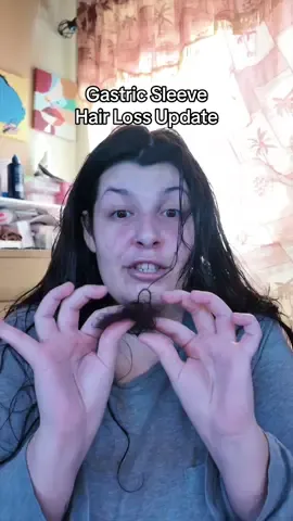 The side effects of weight loss surgery #gastricsleeve #hairloss #weightloss #hairgrowth 