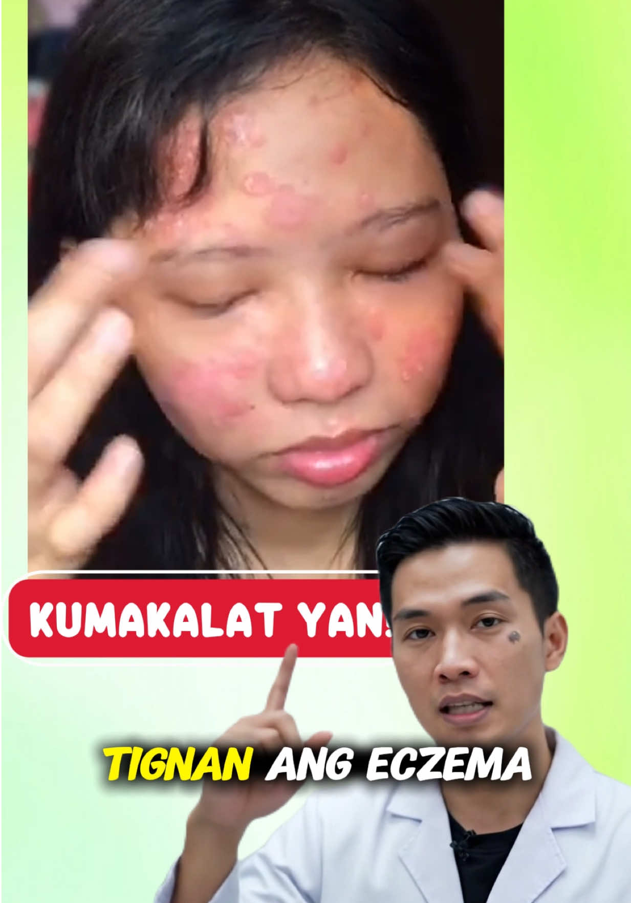 May kilala ka bang nahihirapan sa kanilang skin allergies, eczema, psoriasis at iba pa? ❤️ #organicmanila  #organicmanilamagnesiumsoap 