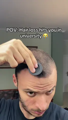 At least I found the best way to hide it 🙈