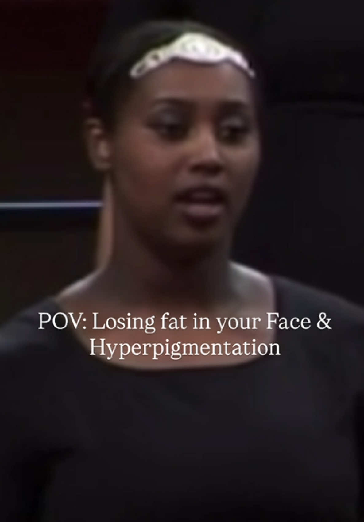 🔥 Hear me when I say this, Hyperpigmentation around the face, neck, armpits, and thigh are symptoms of Diabetes type 2! If you haven’t been diagnosed, you may be dealing pre diabetic symptoms.  I’ve worked with a few clients who actually were able to reverse their symptoms before they fully developed it ‼️ How mine went away & yours will: - Weight Loss, Specifically FAT loss - Lifting weights and doing cardio  - Cleaning up my diet You can reverse your symptoms if you catch it in time. My hyperpigmentation went away fully in most places and reduced tremendously. If you have Diabetes, unfortunately it never goes away, but you can put it into remission by losing weight, being healthy and maintaining it.  I developed this as a kid! Monitor your babies!  #dallaspersonaltrainer #fitnessmotivation #weightlosstransformation #transformation 