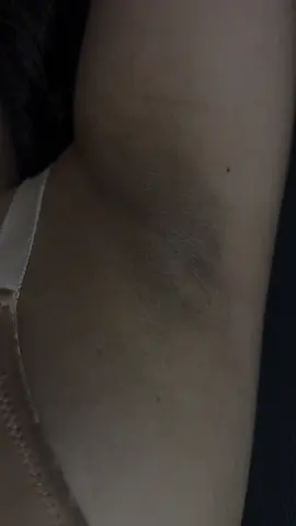 Blanchiment des aisselles ✨ 📍blida 📞0556770034 #fyppppppppppppppppppppppp #شعب_الصيني_ماله_حل😂😂 #بليدة_مدينة_الورود🌹 #تبييض_البشرة_و_الجسم #algerie🇩🇿_maroc🇲🇦_tunisie🇹🇳 