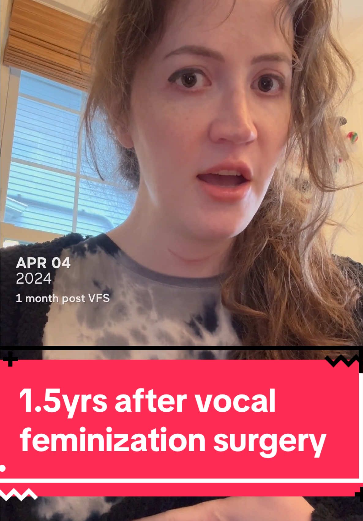 Idk. #transfem #transgirl #transvoice #trans #vocalfeminizationsurgery