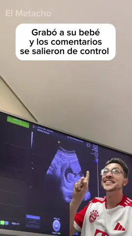 El bebé más saludable del mundo 🤣 #comedia #humor 