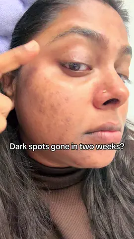 ✨Two weeks to glow mode ON!✨ Using the Seoul 1988 Glow Serum with Niacinamide 15% + Yuja — my skin’s never looked this radiant 🌤️ Dark spots? Fading fast. Dullness? Gone. Now it’s just that glass-skin glow I’ve always wanted 💛 @KSECRET GLOBAL  #KSECRETGlowChallenge #KSECRET #Seoul1988 #GlassSkin #KoreanSkincare      