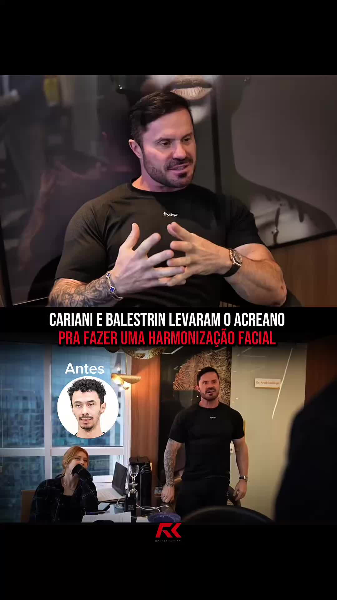 Obrigado @drvitorerlacher por tamanho carinho e atenção com o nosso querido @acreano. E além do antes e depois da aparência do Acre, com certeza existe um antes e depois da autoestima desse menino. Isso impacta demais na vida de alguém, gente… vocês não tem noção. Autoestima muda o olhar, a postura e a forma de encarar a vida. Ela gera confiança. E confiança é o que abre caminho pra qualquer transformação e a sensação de ser capaz de realizar uma infinidade de objetivos! Obrigado Acreano, por permitir que façamos parte desse momento marcante da sua vida, querido❤️🙏🏻