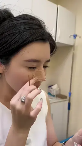 Form mũi quốc dân này chưa bao giờ làm chị em thất vọng 🏥 #viralvideo #xuhuongtiktok #xuhuong #nangmuisline #nangmui 