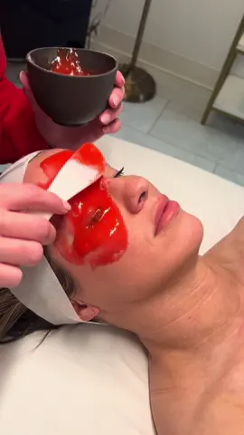 ✨ Boost your skin with the Vampire Pilla Hydrojelly Mask @Absolute Aesthetics & Wellness ! 💧 Deep hydration 🩸 Collagen support 🌟 Radiant, glowing finish This isn’t just skincare—it’s self-care with results. 💆‍♀️ #customfacial #hydrojellymask #kansascity #medspa #hydrafacial