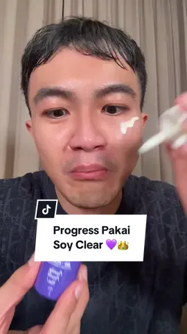 Thank you kak @mikasa𓆩❤︎𓆪 review jujur pemakaian soy clear cysteamine FFY @Finally Found You nya! My skin has #FinallyFoundYou ! 💜🥰👑✨ #promoseruweekend #kerajaanglowing #belilokal #serum 