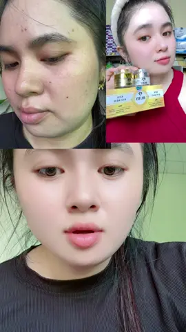 #kem ruby #xuhuongtiktok #thinhhanhxuhuong 