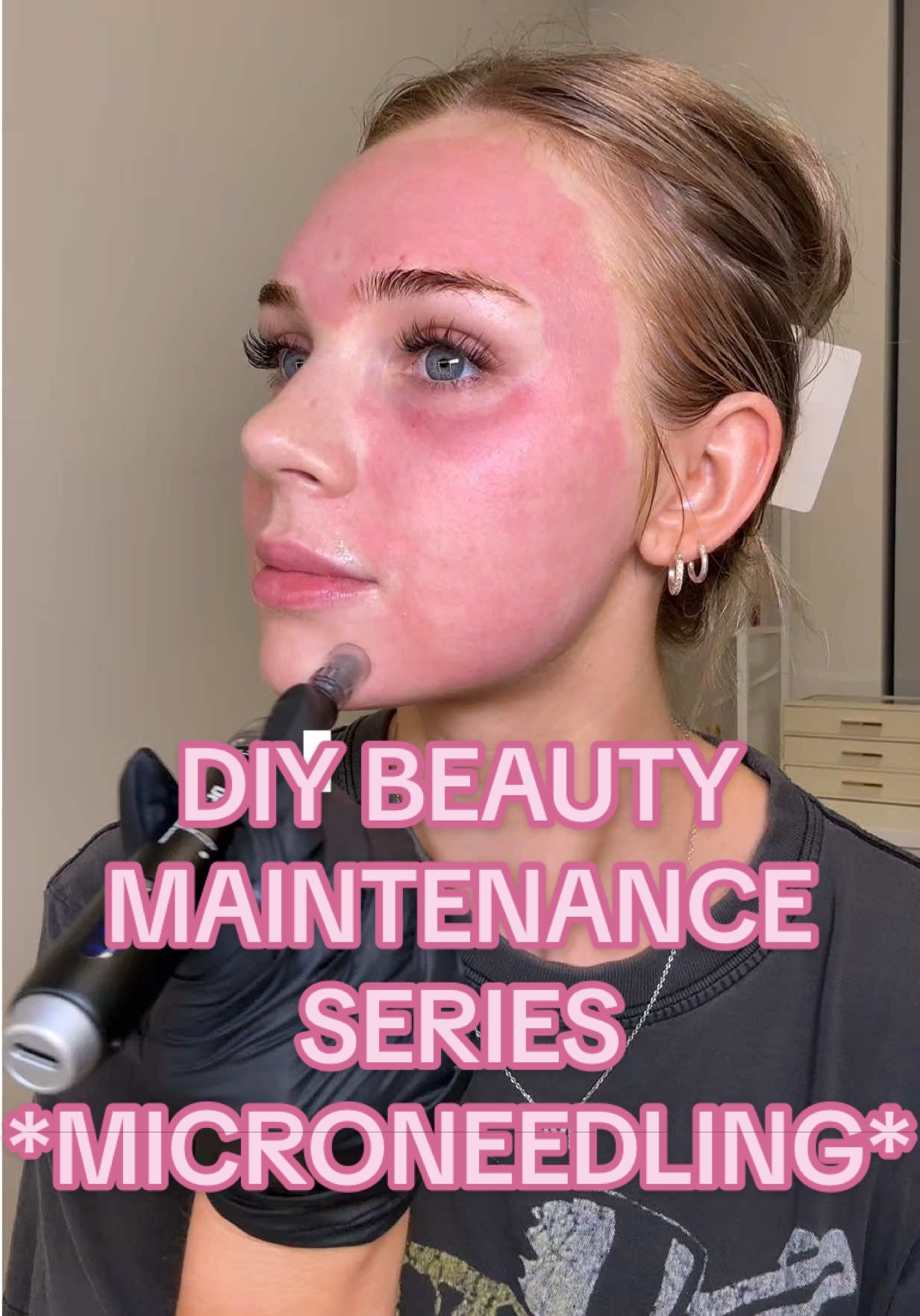 Replying to @GriseldaM.ntes welcome back to part 10 of my DIY beauty maintenance series and today we are MICRONEEDLING AT HOME!!!!  check out @skinwithjayme for more in depth tutorials!! 🫶🏼 #diybeauty #beautymaintenance #highmaintenancetobelowmaintenance #microneedling #microneedlingathome 