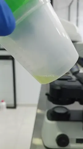 Paciente de la tercera edad 🩸🦠  #laboratory #estadosunidos #laboratory #nurse #paratiiiiiiiiiiiiiiiiiiiiiiiiiiiiiii 