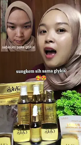 masyaAllah bertahun-tahun pake skincare ga ada perubahan😭😭@Achie Hilman @Ochie Hilman @Glykis  #glykis #skincareviral #skincare 